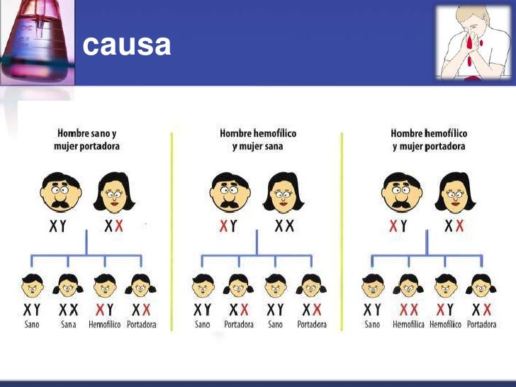Cuando pone mejor la máscara para la persona para la piel mezclada