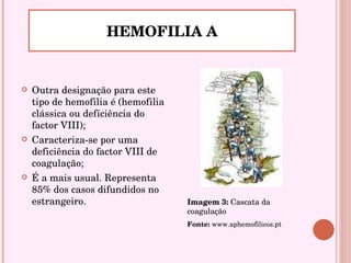 Outra designação para este tipo de hemofilia é (hemofilia clássica ou deficiência do factor VIII); Caracteriza-se por uma deficiência do factor VIII de coagulação; É a mais usual. Representa 85% dos casos difundidos no estrangeiro.  HEMOFILIA A Imagem 3:  Cascata da coagulação Fonte:  www.aphemofilicos.pt 