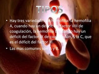 • Hay tres variedades de hemofilia: la hemofilia
A, cuando hay un déficit del factor VIII de
coagulación, la hemofilia B, cuando hay un
déficit del factor IX de coagulación, y la C, que
es el déficit del factor XI.
• Las mas comunes son A y B.

 