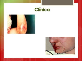 Clínica
 