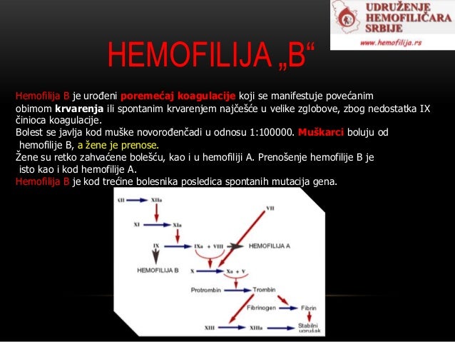 Hemofilija A-B sanja ilic I5
