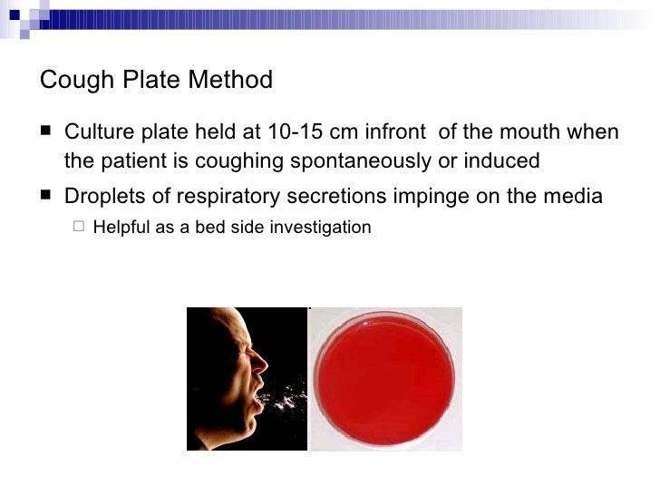 Hemofilus+bordetela+gardnerela