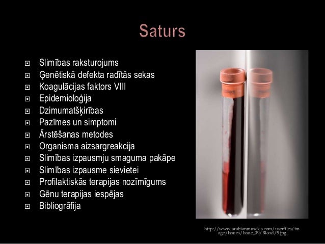 Hemofīlija A