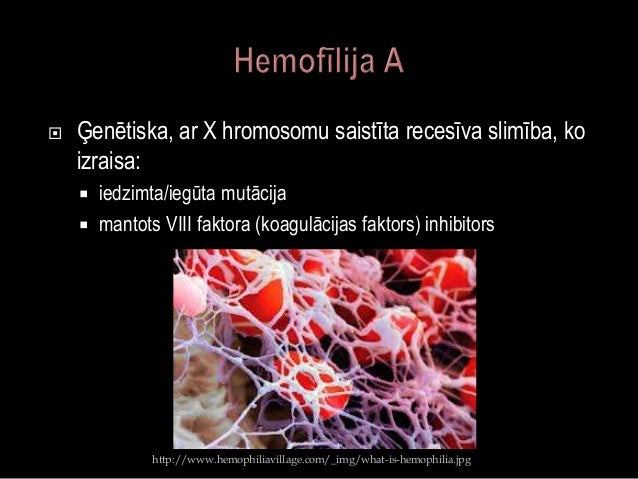 Hemofīlija A