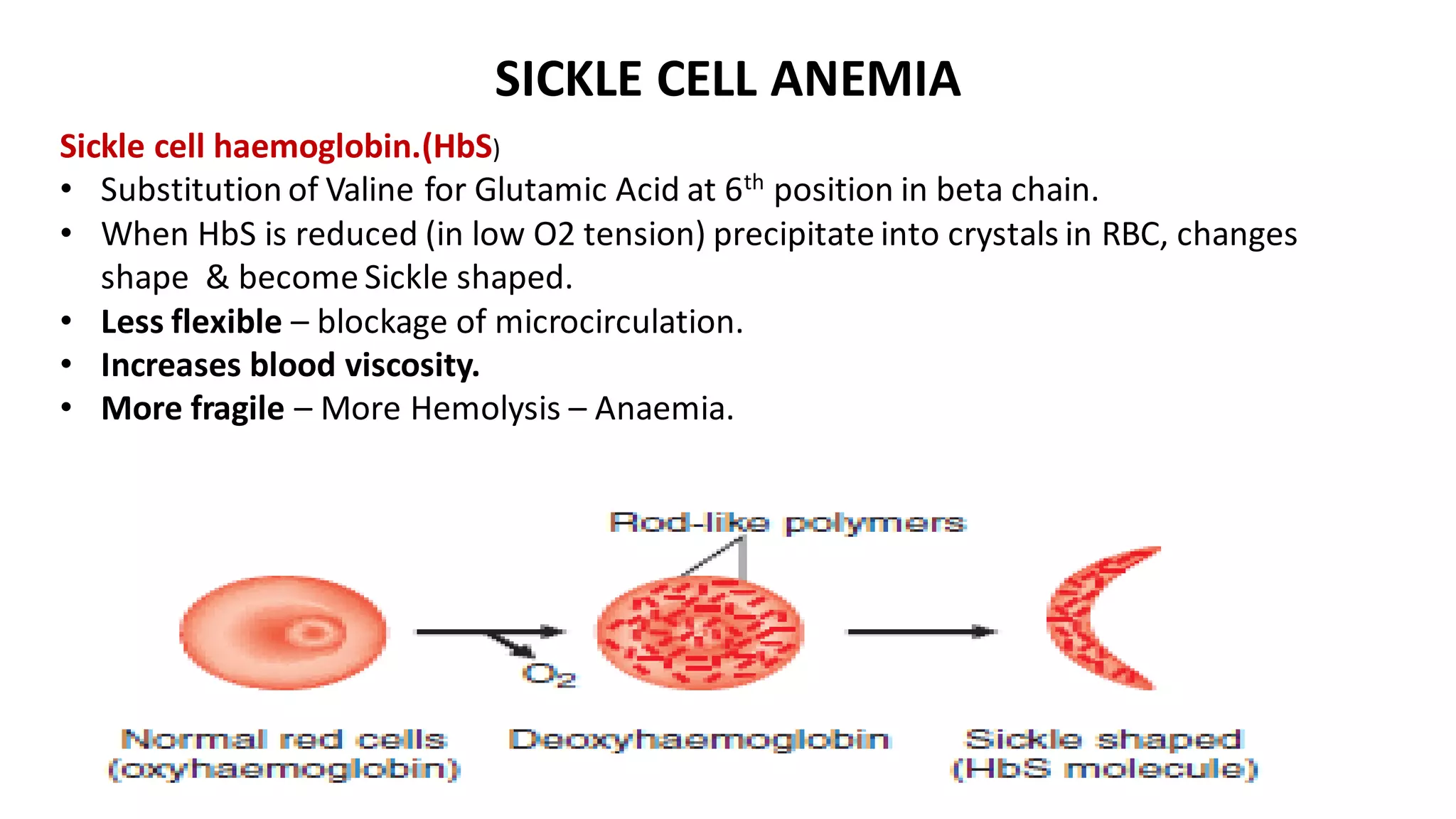 SICKLE CELL ANEMIA
Sickle cell haemoglobin.(HbS)
• Substitution of Valine for Glutamic Acid at 6th position in beta chain.
• When HbS is reduced (in low O2 tension) precipitate into crystals in RBC, changes
shape & become Sickle shaped.
• Less flexible – blockage of microcirculation.
• Increases blood viscosity.
• More fragile – More Hemolysis – Anaemia.
 