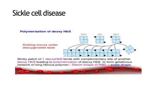 Sickle celldisease
 