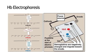 Hb Electrophoresis
 