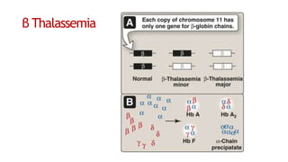 β Thalassemia
 