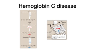 Hemoglobin C disease
for normal RBC, hence, the anemia.] Other symptoms include acute
chest syndrome, stroke, splenic and renal dysfunction, and bone
changes due to marrow hyperplasia. Heterozygotes, representing 1
in 12 African Americans, have one normal and one sickle cell gene.
The blood cells of such heterozygotes contain both HbS and HbA.
These individuals have sickle cell trait. They usually do not show
clinical symptoms (but may under conditions of extreme physical
exertion with dehydration) and can have a normal life span.
1. Amino acid s ubs titution in HbS β chains : A molecule of HbS con-
tains two normal α-globin chains and two mutant β-globin chains
(βS
), in which glutamate at position six has been replaced with
valine (Figure 3.18). Therefore, during electrophoresis at alkaline
pH, HbS migrates more slowly toward the anode (positive elec-
trode) than does HbA (Figure 3.19). This altered mobility of HbS is
a result of the absence of the negatively charged glutamate resi-
dues in the two β chains, thereby rendering HbS less negative than
HbA. [Note: Electrophoresis of hemoglobin obtained from lysed
RBC is routinely used in the diagnosis of sickle cell trait and sickle
cell disease. DNA analysis also is used (see p. 472).]
2. Sickling and tis s ue anoxia: The replacement of the charged glu-
tamate with the nonpolar valine forms a protrusion on the β chain
that fits into a complementary site on the β chain of another hemo-
globin molecule in the cell (Figure 3.20). At low oxygen tension,
deoxyhemoglobin S polymerizes inside the RBC, forming a net-
work of insoluble fibrous polymers that stiffen and distort the cell,
producing rigid, misshapen RBC. Such sickled cells frequently
block the flow of blood in the narrow capillaries. This interruption
in the supply of oxygen leads to localized anoxia (oxygen depriva-
tion) in the tissue, causing pain and eventually death (infarction)
of cells in the vicinity of the blockage. The anoxia also leads to
an increase in deoxygenated HbS. [Note: The mean diameter of
RBC is 7.5 µm, whereas that of the microvasculature is 3–4 µm.
Compared to normal RBC, sickled cells have a decreased ability
36 3. Globular Proteins
Figure 3.18
Amino acid substitutions in
hemoglobin S (HbS) and
Val . His . Leu . Thr . Pro . Glu . Glu . Lys
1 2 3 4 5 6 7 8
C C
H
O
COO-
HbA
HbS
Val . His . Leu . Thr . Pro . Va l . Glu . Lys
CH2
CH2
1 2 3 4 5 6 7 8
Val . His . Leu . Thr . Pro . Lys . Glu . Lys
C C
O
H
HbC
CH2
CH2
CH2
CH2
NH3
+
1 2 3 4 5 6 7 8
C
H
N C
O
CH
CH3
H3C
H
H
N
H
N
that fits into a complementary site on the
globin molecule in the cell (Figure 3.20
deoxyhemoglobin S polymerizes inside
work of insoluble fibrous polymers that
producing rigid, misshapen RBC. Suc
block the flow of blood in the narrow ca
in the supply of oxygen leads to localize
tion) in the tissue, causing pain and ev
of cells in the vicinity of the blockage.
an increase in deoxygenated HbS. [No
RBC is 7.5 µm, whereas that of the mic
Compared to normal RBC, sickled cells
to deform and an increased tendency
and so have difficulty moving through sm
ing microvascular occlusion.]
3. Variables that increas e s ickling: The
therefore, the severity of disease is e
that increases the proportion of HbS
is, reduces the affinity of HbS for O2).
decreased pO2, increased pCO2, decrea
an increased concentration of 2,3-BPG i
4. Treatment: Therapy involves adequa
aggressive antibiotic therapy if infection
sions in patients at high risk for fatal oc
Intermittent transfusions with packed
stroke, but the benefits must be weig
cations of transfusion, which include
erosis), bloodborne infections, and im
Hydroxyurea (hydroxycarbamide), an
peutically useful because it increases
Figure 3.18
Amino acid substitutions in
hemoglobin S (HbS) and
hemoglobin C (HbC).
Val . His . Leu . Thr . Pro . Lys . Glu . Lys
O
HbC
CH2
CH2
CH2
CH2
NH3
+
1 2 3 4 5 6 7 8
Anode
Cathode
Figure 3.19
Diagram of hemoglobins (HbA), (HbS),
and (HbC) after electrophoresis.
Power
s ource
Positions
at the
start of
electro-
phoresis
Gel
ns
s
Gel
Hemoglobins are negatively
charged and migrate toward
the anode.
HbS
HbC
HbA
 