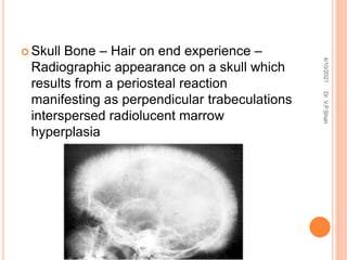  Skull Bone – Hair on end experience –
Radiographic appearance on a skull which
results from a periosteal reaction
manifesting as perpendicular trabeculations
interspersed radiolucent marrow
hyperplasia
4/10/2021
Dr.
V.P.Shah
 