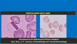 HEMOGLOBIN HbCC-HbEE
Developed by-Dr.Abdulrazzaq Othman Alagbare
M.D M.S.c C.P - Lecturer of Hematology and Immunohematology
1
 