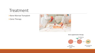 Treatment
Bone Marrow Transplant
Gene Therapy
 