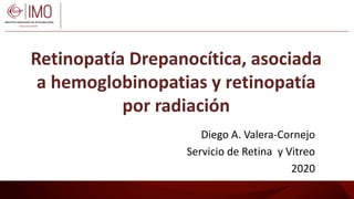 Retinopatía Drepanocítica, asociada
a hemoglobinopatias y retinopatía
por radiación
Diego A. Valera-Cornejo
Servicio de Retina y Vitreo
2020
 