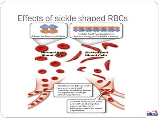 hemoglobinstructureandmetabolism-210212151146.ppt