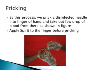  By this process, we prick a disinfected needle
into finger of hand and take out few drop of
blood from there as shown in figure
 Apply Spirit to the finger before pricking
 