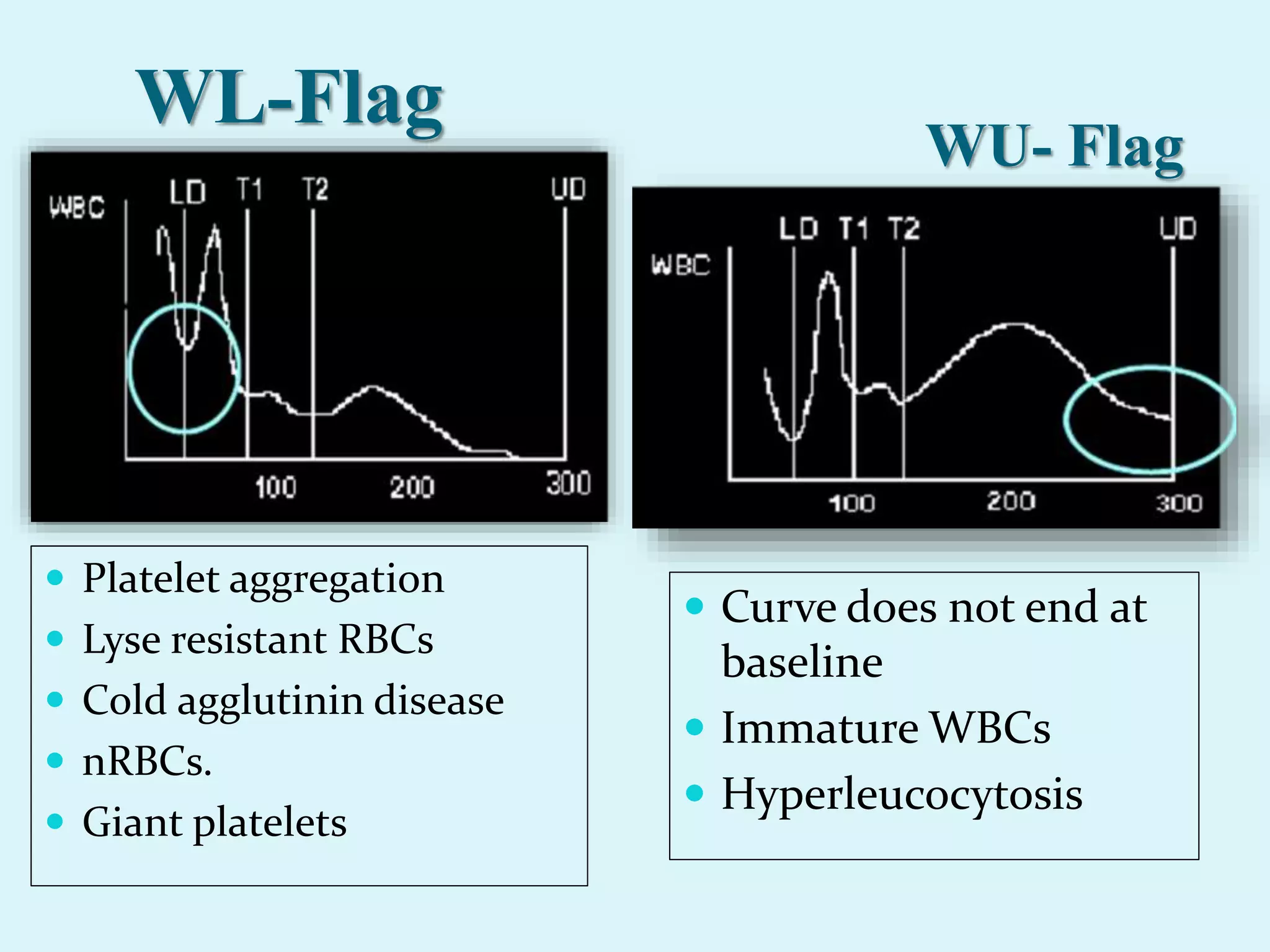 WL-Flag
 Platelet aggregation
 Lyse resistant RBCs
 Cold agglutinin disease
 nRBCs.
 Giant platelets
WU- Flag
 Curve does not end at
baseline
 Immature WBCs
 Hyperleucocytosis
 