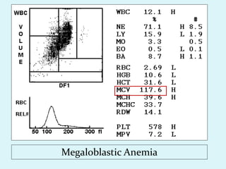 Megaloblastic Anemia
 