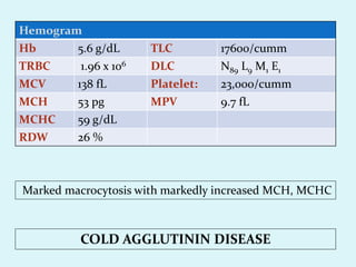 Marked macrocytosis with markedly increased MCH, MCHC
COLD AGGLUTININ DISEASE
Hemogram
Hb 5.6 g/dL TLC 17600/cumm
TRBC 1.96 x 106 DLC N89 L9 M1 E1
MCV 138 fL Platelet: 23,000/cumm
MCH 53 pg MPV 9.7 fL
MCHC 59 g/dL
RDW 26 %
 