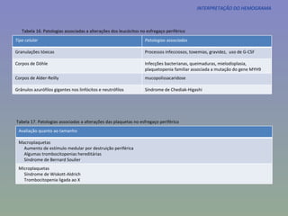 INTERPRETAÇÃO DO HEMOGRAMA Tabela 16. Patologias associadas a alterações dos leucócitos no esfregaço periférico  Tabela 17. Patologias associadas a alterações das plaquetas no esfregaço periférico  Tipo celular Patologias associadas Granulações tóxicas Processos infecciosos, toxemias, gravidez,  uso de G-CSF Corpos de Döhle Infecções bacterianas, queimaduras, mielodisplasia, plaquetopenia familiar associada a mutação do gene MYH9 Corpos de Alder-Reilly mucopolissacaridose Grânulos azurófilos gigantes nos linfócitos e neutrófilos Síndrome de Chediak-Higashi Avaliação quanto ao tamanho Macroplaquetas Aumento de estímulo medular por destruição periférica Algumas trombocitopenias hereditárias Síndrome de Bernard Soulier Microplaquetas Síndrome de Wiskott-Aldrich Trombocitopenia ligada ao X 
