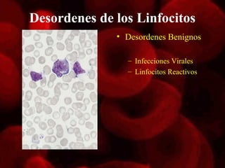 Desordenes de los Linfocitos
              • Desordenes Benignos

                – Infecciones Virales
                – Linfocitos Reactivos
 