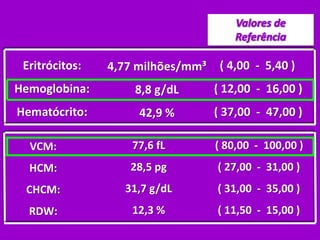 Eritrócitos:
Hemoglobina:
Hematócrito:
4,77 milhões/mm³
8,8 g/dL
42,9 %
( 4,00 - 5,40 )
( 12,00 - 16,00 )
( 37,00 - 47,00 )
VCM:
HCM:
CHCM:
RDW:
77,6 fL
28,5 pg
31,7 g/dL
12,3 %
( 80,00 - 100,00 )
( 27,00 - 31,00 )
( 31,00 - 35,00 )
( 11,50 - 15,00 )
 