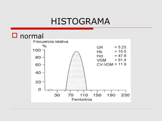 HISTOGRAMA
 normal
 
