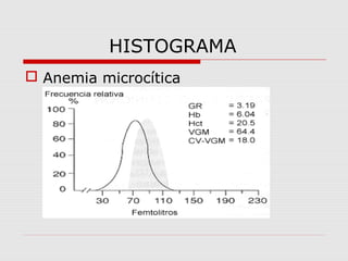 HISTOGRAMA
 Anemia microcítica
 