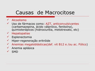 Causas de Macrocitose
 Alcoolismo
 Uso de fármacos como: AZT, anticonvulsivantes
(carbamazepina, ácido válpróico, fenitoína),
quimioterápicos (hidroxiuréia, metotrexato, etc)
 Hepatopatias
 Esplenectomia
 Hiper-regeneração eritróide
 Anemias megaloblásticas(def. vit B12 e /ou ac. Fólico)
 Anemia aplásica
 SMD
 