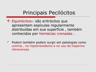 Principais Pecilócitos
 Equinócitos– são eritrócitos que
apresentam espículas regularmente
distribuídas em sua superfície , também
conhecidos por hemácias crenadas .
 Podem também podem surgir em patologias como
uremia , no hipotireoidismo e no uso de heparina
intravenosa
 