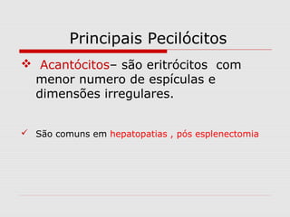 Principais Pecilócitos
 Acantócitos– são eritrócitos com
menor numero de espículas e
dimensões irregulares.
 São comuns em hepatopatias , pós esplenectomia
 