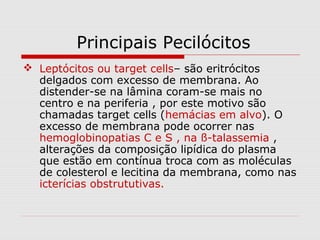 Principais Pecilócitos
 Leptócitos ou target cells– são eritrócitos
delgados com excesso de membrana. Ao
distender-se na lâmina coram-se mais no
centro e na periferia , por este motivo são
chamadas target cells (hemácias em alvo). O
excesso de membrana pode ocorrer nas
hemoglobinopatias C e S , na ß-talassemia ,
alterações da composição lipídica do plasma
que estão em contínua troca com as moléculas
de colesterol e lecitina da membrana, como nas
icterícias obstrututivas.
 