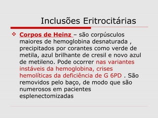 Inclusões Eritrocitárias
 Corpos de Heinz – são corpúsculos
maiores de hemoglobina desnaturada ,
precipitados por corantes como verde de
metila, azul brilhante de cresil e novo azul
de metileno. Pode ocorrer nas variantes
instáveis da hemoglobina, crises
hemolíticas da deficiência de G 6PD . São
removidos pelo baço, de modo que são
numerosos em pacientes
esplenectomizadas
 