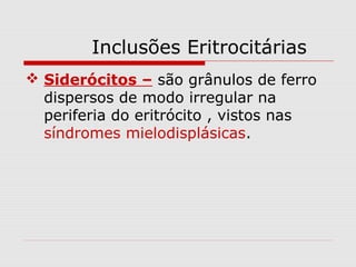 Inclusões Eritrocitárias
 Siderócitos – são grânulos de ferro
dispersos de modo irregular na
periferia do eritrócito , vistos nas
síndromes mielodisplásicas.
 
