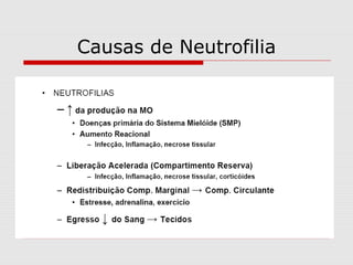 Causas de Neutrofilia
 