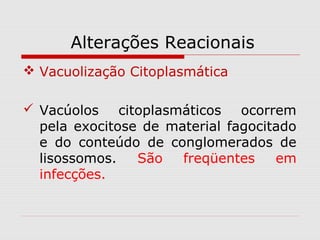 Alterações Reacionais
 Vacuolização Citoplasmática
 Vacúolos citoplasmáticos ocorrem
pela exocitose de material fagocitado
e do conteúdo de conglomerados de
lisossomos. São freqüentes em
infecções.
 