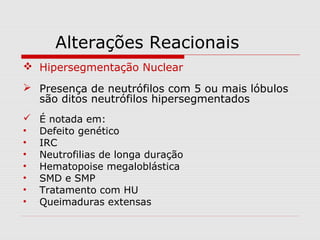 Alterações Reacionais
 Hipersegmentação Nuclear
 Presença de neutrófilos com 5 ou mais lóbulos
são ditos neutrófilos hipersegmentados
 É notada em:
• Defeito genético
• IRC
• Neutrofilias de longa duração
• Hematopoise megaloblástica
• SMD e SMP
• Tratamento com HU
• Queimaduras extensas
 