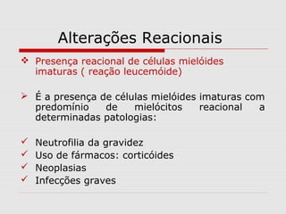 Alterações Reacionais
 Presença reacional de células mielóides
imaturas ( reação leucemóide)
 É a presença de células mielóides imaturas com
predomínio de mielócitos reacional a
determinadas patologias:
 Neutrofilia da gravidez
 Uso de fármacos: corticóides
 Neoplasias
 Infecções graves
 