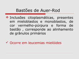 Bastões de Auer-Rod
 Inclusões citoplasmáticas, presentes
em mieloblastos e monoblastos, de
cor vermelho-púrpura e forma de
bastão , corresponde ao alinhamento
de grânulos primários
 Ocorre em leucemias mielóides
 