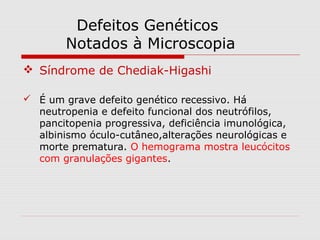 Defeitos Genéticos
Notados à Microscopia
 Síndrome de Chediak-Higashi
 É um grave defeito genético recessivo. Há
neutropenia e defeito funcional dos neutrófilos,
pancitopenia progressiva, deficiência imunológica,
albinismo óculo-cutâneo,alterações neurológicas e
morte prematura. O hemograma mostra leucócitos
com granulações gigantes.
 