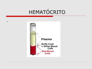 HEMATÓCRITO
.
 