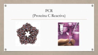 PCR
(Proteína C Reactiva)
 