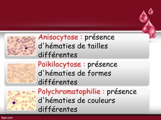 Anisocytose : présence
d'hématies de tailles
différentes
Poïkilocytose : présence
d'hématies de formes
différentes
Polychromatophilie : présence
d'hématies de couleurs
différentes
 