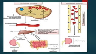Hemolysis of Rbc updated.pptx clinical hematology | PPTX
