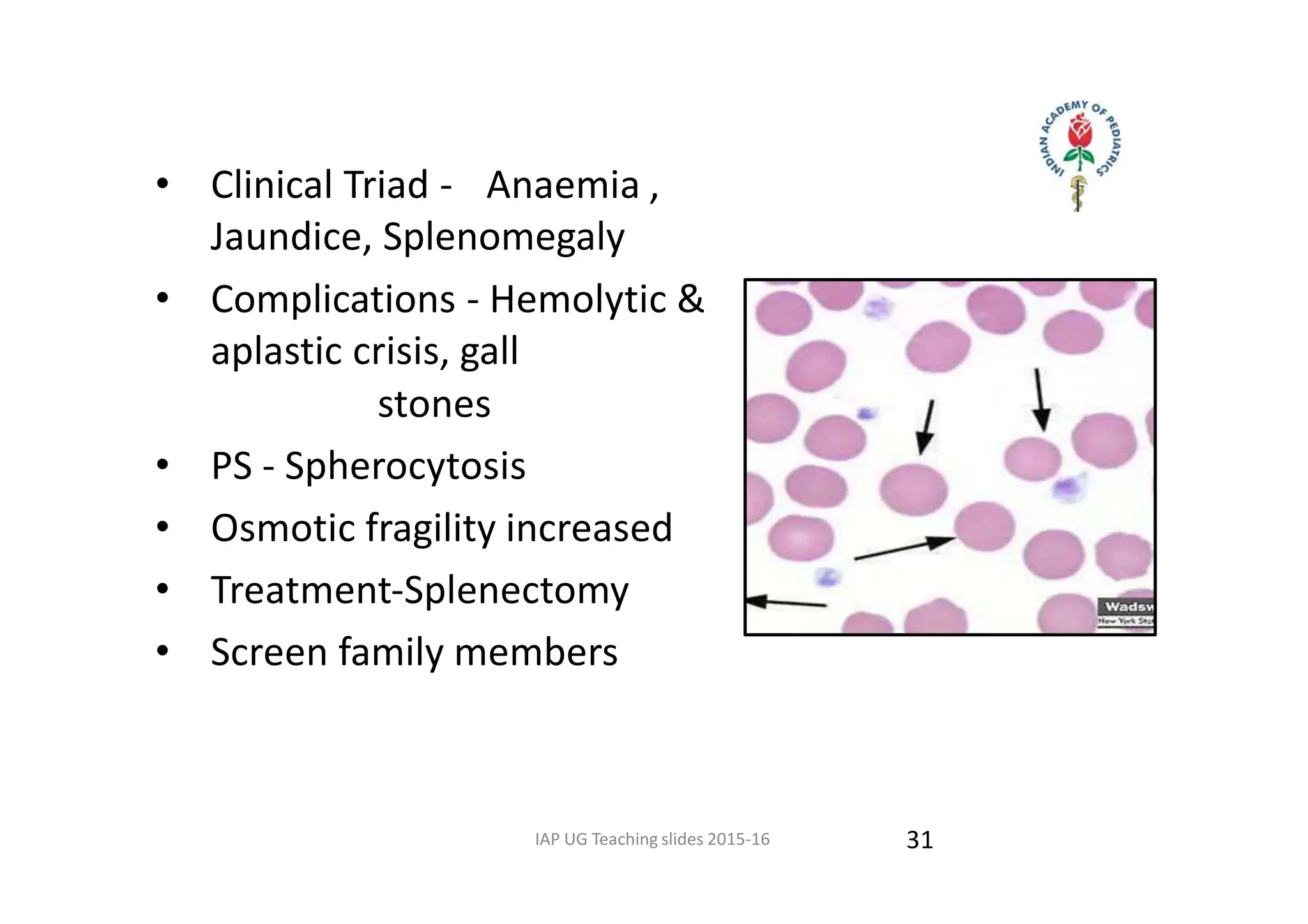 Hemolytic-Anemia - a review of Hemolytic-Anemia | PPT