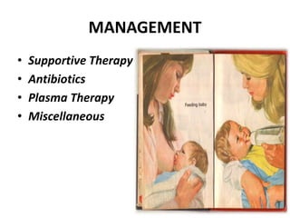 MANAGEMENT
• Supportive Therapy
• Antibiotics
• Plasma Therapy
• Miscellaneous
 