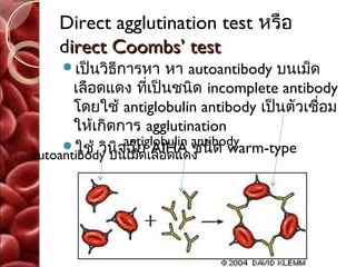 Direct agglutination test หรือ
    direct Coombs’ test
    เป็นวิธีการหา     หา autoantibody บนเม็ด
       เลือดแดง ที่เป็นชนิด incomplete antibody
       โดยใช้ antiglobulin antibody เป็นตัวเชือม
                                              ่
       ให้เกิดการ agglutination
     ใช้ วินิจฉัย AIHA antibody
               antiglobulin
autoantibody บนเม็ดเลือดแดง ด warm-type
                            ชนิ
 