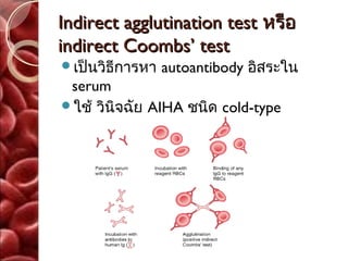 Indirect agglutination test หรือ
indirect Coombs’ test
เป็นวิธีการหา   autoantibody อิสระใน
 serum
ใช้ วินิจฉัย AIHA ชนิด cold-type
 