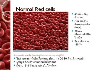 Normal Red cells
                                                          ลักษณะ ค่อน
                                                           ข้างกลม
                                                          เว้าตรงกลาง
                                                           (biconcave disc
                                                           shape)
                                                          มีสีแดง
                                                           เนื่องจากมี ฮีโม
                                                           โกลบิน
                                                          มีอายุประมาณ
                                                           120 วัน



ถ่ายภาพด้วยเทคนิค Scanning Electron Microscope(SEM)
 ในร่างกายจะมีเม็ดเลือดแดง ประมาณ 20-30              ล้านล้านเซลล์
 ผูหญิง
    ้   4-5 ล้านเซลล์ต่อไมโครลิตร
 ผูชาย 5-6 ล้านเซลล์ต่อไมโครลิตร
    ้
 