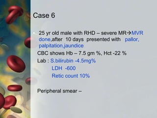 Case 6
• 25 yr old male with RHD – severe MRMVR
done,after 10 days presented with pallor,
palpitation,jaundice
CBC shows Hb – 7.5 gm %, Hct -22 %
Lab : S.bilirubin -4.5mg%
LDH -600
Retic count 10%
Peripheral smear –
 
