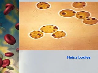 Heinz bodies
 